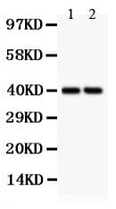 Polyclonal Rabbit anti-Human SFRP4 Antibody (aa140-346, WB)