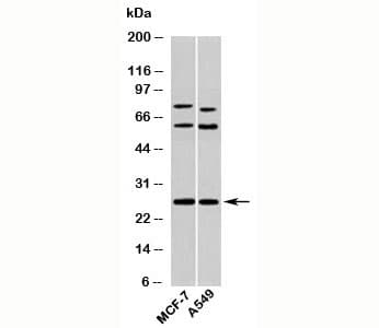 Polyclonal Rabbit anti-Human SDC4 / Syndecan 4 Antibody (N-Terminus, WB)