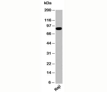 IKBKB / IKK2 / IKK Beta Antibody (clone IKB355)