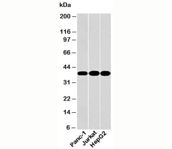 Monoclonal Mouse anti-Human GAPDH Antibody (clone GAP259, C-Terminus, WB)