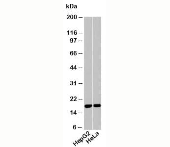 Polyclonal Rabbit anti-Human Acid Phosphatase Antibody (WB)