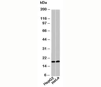 Acid Phosphatase Antibody (N-Terminus)