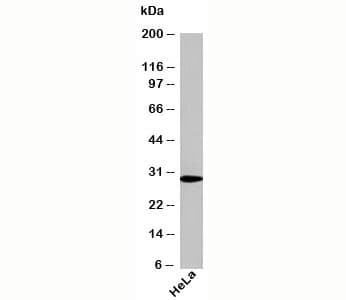 Polyclonal Rabbit anti-Human NQO1 Antibody (C-Terminus, WB)