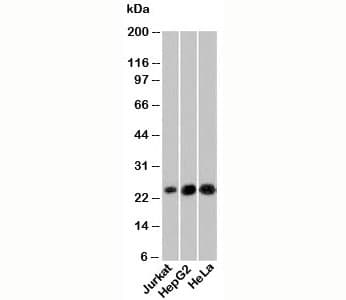 Monoclonal Mouse anti-Human NKIRAS1 Antibody (clone NRAS285, WB)