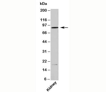 Polyclonal Rabbit anti-Mouse Ifi204 Antibody (N-Terminus, WB)