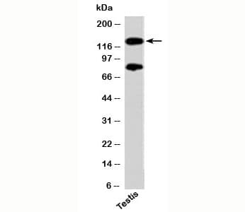 Polyclonal Rabbit anti-Human PER2 Antibody (C-Terminus, WB)