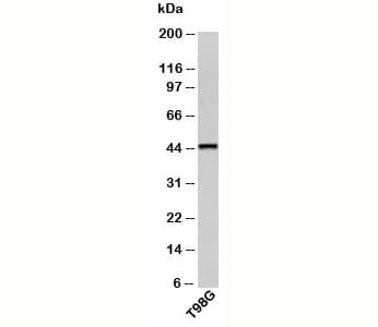Polyclonal Rabbit anti-Human CRHR2 / CRF2 Receptor Antibody (N-Terminus, WB)