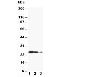 TIMP3 Antibody (aa198-211)