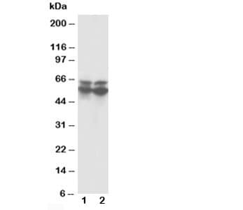 Polyclonal Rabbit anti-Human CBFA1 / RUNX2 Antibody (aa244-258, WB)