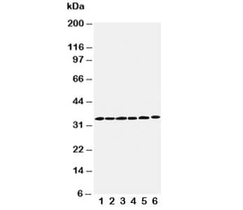 Polyclonal Rabbit anti-Human CCND1 / Cyclin D1 Antibody (aa219-238, WB)