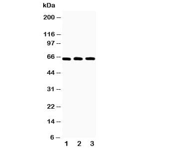 TNFRSF11A / RANK Antibody (aa29-44)