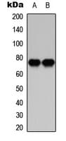 PRKCB / PKC-Beta Antibody (C-Terminus)