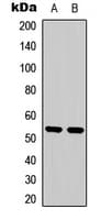PTEN Antibody (C-Terminus)