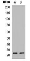 Polyclonal Rabbit anti-Human PTGES3 / p23 Antibody (Internal, IHC, WB)