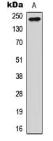 Polyclonal Rabbit anti-Human RTN4 / Nogo Antibody (Internal, IHC, WB)