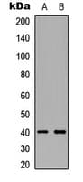 TNFSF11 / RANKL / TRANCE Antibody (Internal)