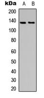 Polyclonal Rabbit anti-Human TNK2 / ACK1 Antibody (phospho-Tyr284, IHC, IF, WB)