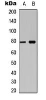 Polyclonal Rabbit anti-Human BCL6 Antibody (phospho-Ser333, WB)