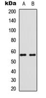 Polyclonal Rabbit anti-Human BMP6 Antibody (Internal, WB)