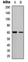 Polyclonal Rabbit anti-Human CDC25C Antibody (phospho-Ser216, IHC, IF, WB)