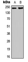 Polyclonal Rabbit anti-Human ESPL1 / Separase Antibody (Internal, IHC, IF, WB)