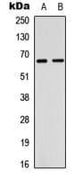 ER Alpha / Estrogen Receptor Antibody (Internal)