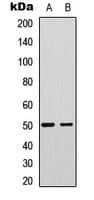 Polyclonal Rabbit anti-Human FBLN5 / Fibulin 5 Antibody (Internal, WB)