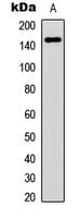 FLT1 / VEGFR1 Antibody (C-Terminus)