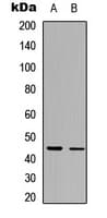 Polyclonal Rabbit anti-Human IL13RA2 / IL13R Alpha 2 Antibody (Internal, WB)