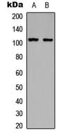 Polyclonal Rabbit anti-Human ITGB3 / Integrin Beta 3 / CD61 Antibody (C-Terminus, WB)