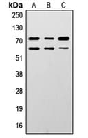 Polyclonal Rabbit anti-Human LMNA / Lamin A+C Antibody (N-Terminus, IHC, WB)