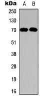 NF2 / Merlin Antibody (aa506-545)