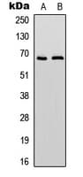 Polyclonal Rabbit anti-Human PTPN6 / SHP1 Antibody (C-Terminus, IHC, WB)