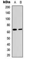 RELA / NFKB p65 Antibody (Acetyl-Lys221)