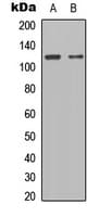 Polyclonal Rabbit anti-Human STAT2 Antibody (C-Terminus, IHC, WB)
