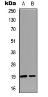 STMN1 / Stathmin / LAG Antibody (N-Terminus)