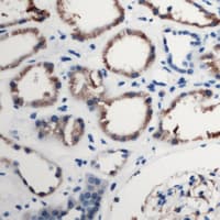 Polyclonal Rabbit anti-Human C5AR1 / CD88 / C5a Receptor Antibody (C-Terminus, IHC, IF, WB)