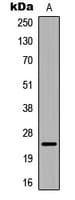 Polyclonal Rabbit anti-Human CRYAB / Alpha B Crystallin Antibody (N-Terminus, IHC, WB)
