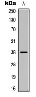 Polyclonal Rabbit anti-Human CSNK1A1 / CK1 Alpha Antibody (C-Terminus, IHC, WB)