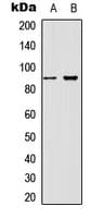 Polyclonal Rabbit anti-Human CTNNB1 / Beta Catenin Antibody (N-Terminus, WB)