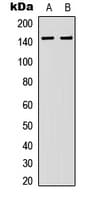 Polyclonal Rabbit anti-Human DGKK Antibody (C-Terminus, IHC, IF, WB)