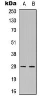 Polyclonal Rabbit anti-Human FADD Antibody (C-Terminus, IHC, WB)