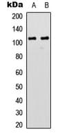 GRIN1 / NMDAR1 Antibody (C-Terminus)