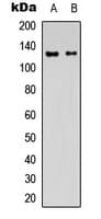 Polyclonal Rabbit anti-Human GRIN1 / NMDAR1 Antibody (C-Terminus, WB)