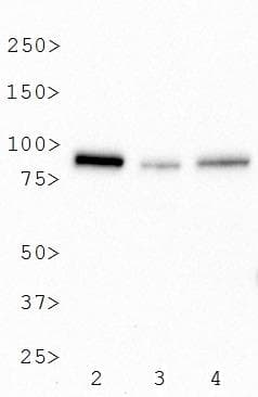 BTK Antibody (C-Terminus, clone 7F12H4)