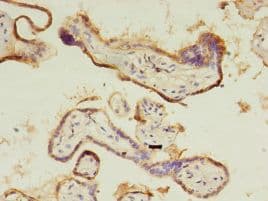 CTHRC1 Antibody