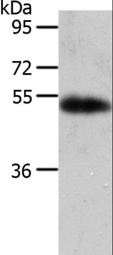 Polyclonal Rabbit anti-Human AGT / Angiotensinogen Antibody (IHC, WB)