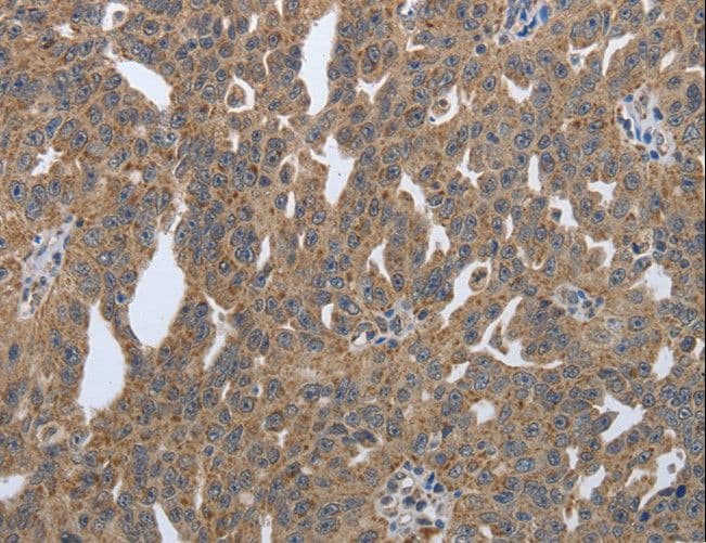 Polyclonal Rabbit anti-Human PDIA2 Antibody (IHC)