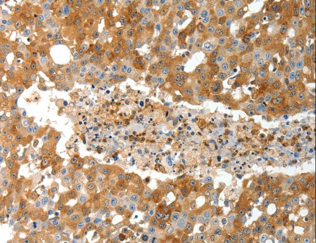 Polyclonal Rabbit anti-Human TP1 / TEP1 Antibody (IHC)