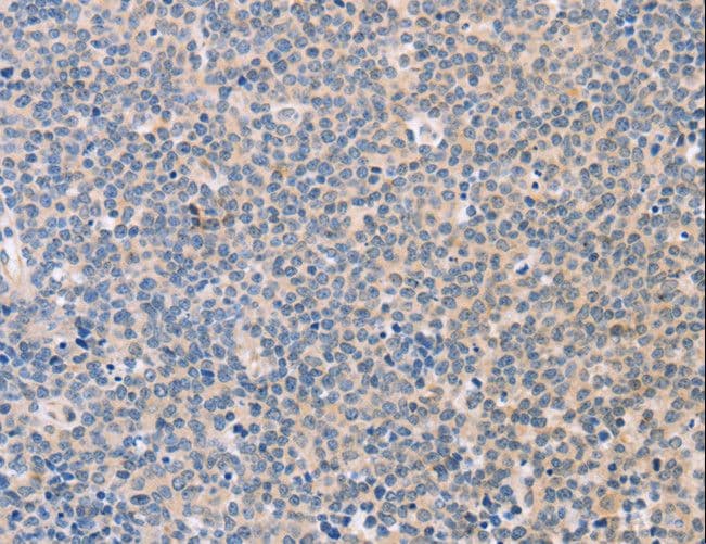 Polyclonal Rabbit anti-Human NCAM / CD56 Antibody (IHC)
